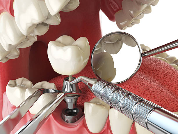 Best Root Canal Emergency Dentist  in Lyons, GA